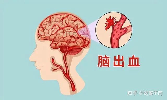 高血压的危害你注意了吗？
